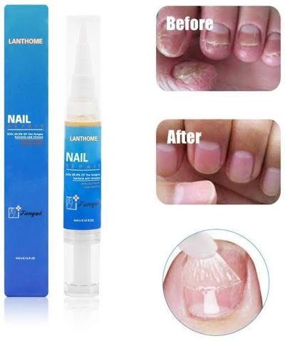 Lanthome nail repair